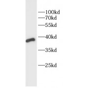 WB analysis of Rat kidney, using MTNR1A antibody (1/1000 dilution).