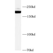 WB analysis of mouse heart, using SCN7A antibody (1/1000 dilution).