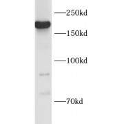 WB analysis of MCF7 cells, using NES antibody (1/1000 dilution).