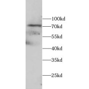 WB analysis of Mouse brain tissue, using LGP2 antibody (1/1000 dilution).