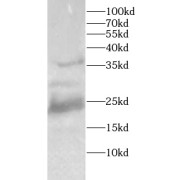 abx240181
