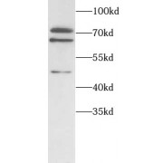 WB analysis of Jurkat cells, using ITK antibody (1/1000 dilution).