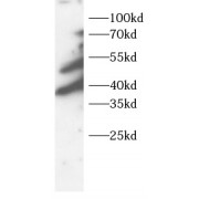 WB analysis of MCF7 cell lysates, using STOML2 antibody (1/1000 dilution).