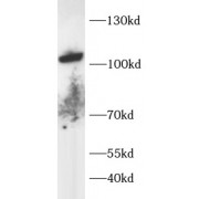 WB analysis of 293T cell lysates, using TRPV1 antibody (1/1000 dilution).