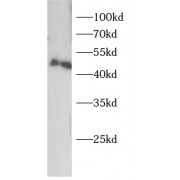WB analysis of rat liver tissue, using OAS1 antibody (1/1000 dilution).