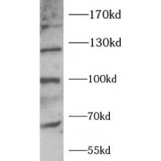 WB analysis of Raji cells, using LDLR antibody (1/1000 dilution).