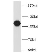 WB analysis of K562 cells, using LAMP1 antibody (1/5000 dilution).