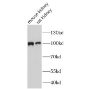 WB analysis of various lysates, using VILL antibody (1/1000 dilution).