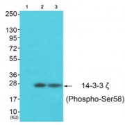 Western blot analysis of extracts from A549 cells (Lane 2) and 3T3 cells (Lane 3), using 14-3-3 zeta (Phospho-Ser58) Antibody. The lane on the left is treated with synthesized peptide.