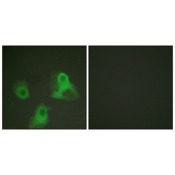 ADD1 (Phospho-Ser726) Antibody