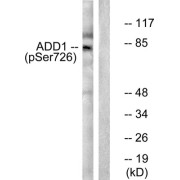 Western blot analysis of extracts from Hela cells treated with Forskolin (40nM, 30mins), using ADD1 (phospho-Ser726) antibody (abx012401).