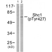 Western blot analysis of extracts from Hela cells treated with Calyculin A (50ng/ml, 15mins), using Shc (phospho-Tyr427) antibody.