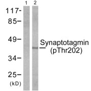 Western blot analysis of extracts from Hela cells treated with Forskolin (40nM, 30mins), using Synaptotagmin (phospho-Thr202) antibody.