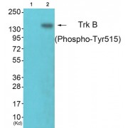 Western blot analysis of extracts from NIH/3T3 cells, using Trk B (phospho-Tyr515) antibody.