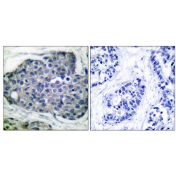 Acetyl-CoA Carboxylase (Phospho-Ser80) Antibody