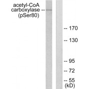 Western blot analysis of extracts from 293 cells treated with EGF (200ng/ml, 5mins), using Acetyl-CoA Carboxylase (phospho-Ser80) antibody.