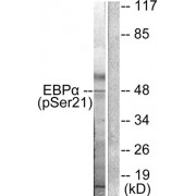 Western blot analysis of extracts from HepG2 cells treated with EGF (200ng/ml, 5mins), using C/EBP- alpha (phospho-Ser21) antibody.