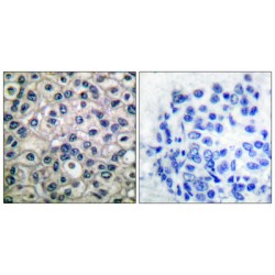 Breast Cancer Anti-Estrogen Resistance Protein 1 Phospho-Tyr410 (BCAR1 pY410) Antibody