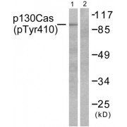 Western blot analysis of extracts from NIH/3T3 cells, using p130 Cas (Phospho-Tyr410) antibody (abx012424).