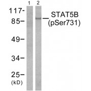 Western blot analysis of extracts from RAW264.7 cells, treated with EGF (200ng/ml, 30mins), using STAT5B (phospho-Ser731) antibody.