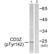Western blot analysis of extracts from Jurkat cells treated with UV for 15 mins, using CD3 zeta (Phospho-Tyr142) antibody. The lane on the right is treated with blocking peptide.