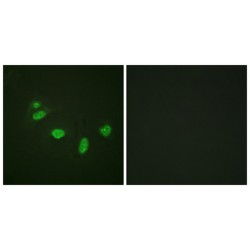 Protein C-Ets-1 Phospho-Thr38 (ETS1 pT38) Antibody
