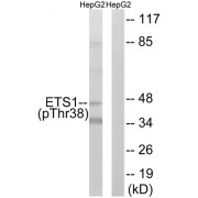 Western blot analysis of extracts from HepG2 cells, using ETS1 (Phospho-Thr38) antibody.