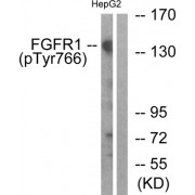 Western blot analysis of extracts from HepG2 cells, treated with EGF (200ng/ml, 30mins), using FGFR1 (Phospho-Tyr766) antibody.