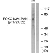 Western blot analysis of extracts from 293 cells, treated with Serum (20%, 15mins), using FOXO1 (Phospho-Thr24/32) antibody. Lane on the right was treated with P-peptide.