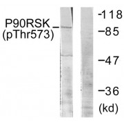 Western blot analysis of extracts from 293 cells, treated with UV (30mins), using p90 RSK (Phospho-Thr573) antibody.
