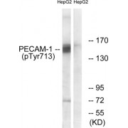 Western blot analysis of extracts from HepG2 cells, using PECAM-1 (Phospho-Tyr713) antibody.