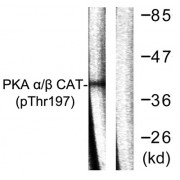 Western blot analysis of lysates from mouse brain, using PKA alpha/beta CAT (Phospho-Thr197) Antibody. The lane on the right is blocked with the phosphopeptide.