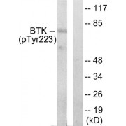 Western blot analysis of extracts from Hela cells treated with serum (10%, 15 min), using BTK (phospho-Tyr223) antibody. The lane on the right is blocked with the phosphopeptide.
