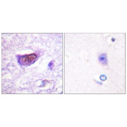 Steroidogenic Factor 1 Phospho-Ser82 (SF1 pS82) Antibody