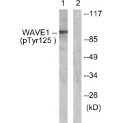 Western blot analysis of extracts from NIH/3T3 cells, treated with Insulin (0.01U/ml, 15mins), using WAVE1 (Phospho-Tyr125) antibody.