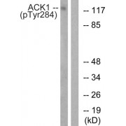 Western blot analysis of extracts from HepG2 cells, treated with EGF (200ng/ml, 30mins), using ACK1 (Phospho-Tyr284) antibody.