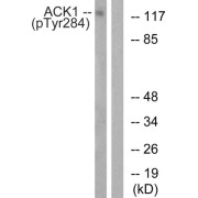 Western blot analysis of extracts from HepG2 cells, treated with EGF (200ng/ml, 30mins), using ACK1 (Phospho-Tyr284) antibody.