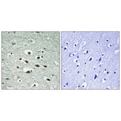 Serine/Threonine-Protein Kinase CHK1 Phospho-Ser296 (CHEK1 pS296) Antibody