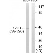 Western blot analysis of extracts from HUVEC cells, treated with UV (15mins), using CHK1 (Phospho-Ser296) antibody.