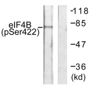 Western blot analysis of extracts from NIH/3T3cells, using eIF4B (Phospho-Ser422) antibody.