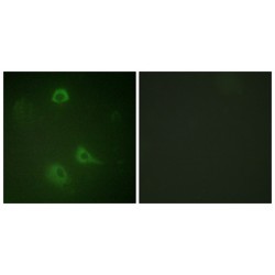 Glutamate Receptor Ionotropic, NMDA 1 Phospho-Ser890 (GRIN1 pS890) Antibody
