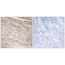 PEA-15 (Phospho-Ser104) Antibody