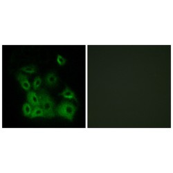 Bcl2 Associated X Protein Phospho-Thr167 (BAX pT167) Antibody