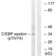 Western blot analysis of extracts from HUVEC cells, treated with UV (15mins), using C/EBP epsilon (phospho-Thr74) antibody.