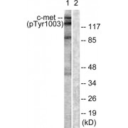 Western blot analysis of extracts from HepG2 cells, using c-Met (Phospho-Tyr1003) antibody.