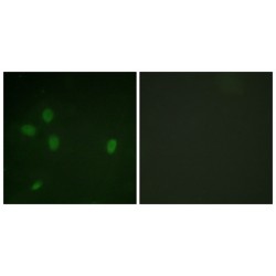 Tumor Protein p53 Binding Protein 1 (TP53BP1) Antibody