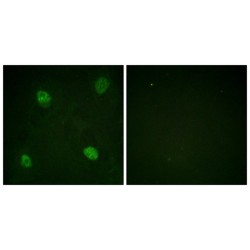 hnRPD (Phospho-Ser83) Antibody