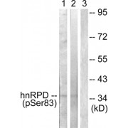 Western blot analysis of extracts from HuvEc cells (lane 1) and HT29 cells (lane 2), using hnRPD (Phospho-Ser83) antibody.