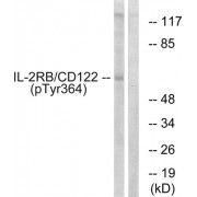 Western blot analysis of extracts from COS7 cells, using IL-2R beta /CD122 (Phospho-Tyr364) antibody.