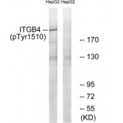 Western blot analysis of extracts from HepG2 cells, treated with Na2VO3 (0.3nM, 40mins), using ITGB4 (Phospho-Tyr1510) antibody.
